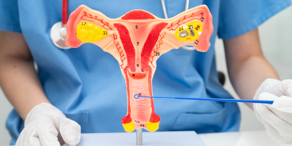 How to Treat Uterine Fibroids: Medicines, Surgery & Latest Techniques